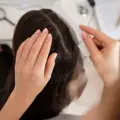 Hair Dandruff Treatment